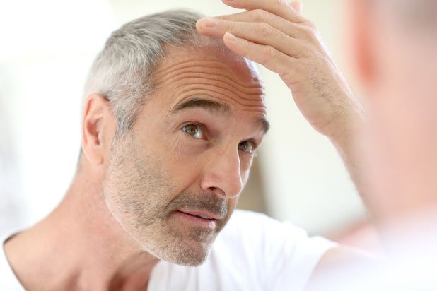 generic finasteride man hair loss