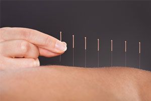 Acupuncture pour la dysfonction érectile