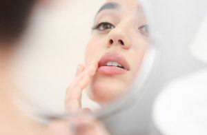 woman with cold sore on lip looking in mirror